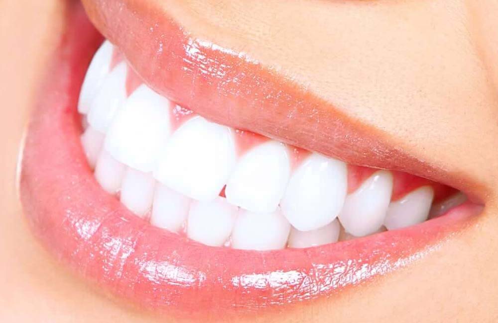 Teeth Whitening Image
