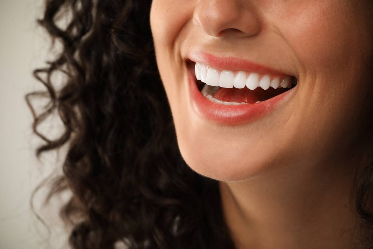 Woman smiling, revealing a new set of veneers.
